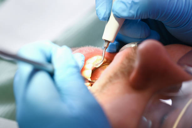 Best Emergency Treatment for Toothache in Rocky Mount, NC