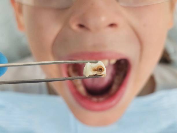 Best After-Hours Emergency Dentist in Rocky Mount, NC